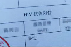 我们青梅竹马老公婚检出HIV携带者该何去何从